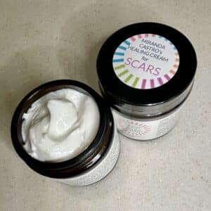 Miranda's Healing Cream for Scars